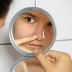 7 Best Ways To Deal With Having Acne