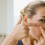 Acne Treatment Do’s and Don’ts: Useful Guidelines