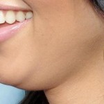 5 Wonderfully Tips for How to Get Rid of a Double Chin